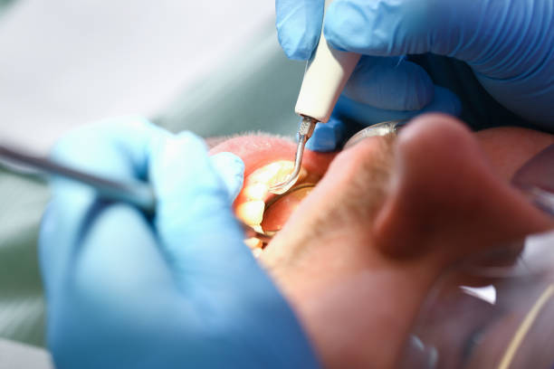 Best Emergency Broken Tooth Repair in Auburn, IL